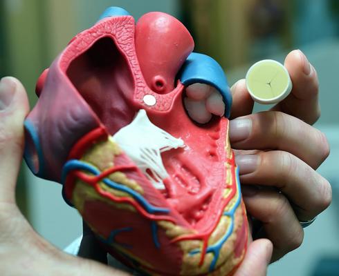 Xeltis: "living" heart valves made of biodegradable polymers | Brabant Brand Box
