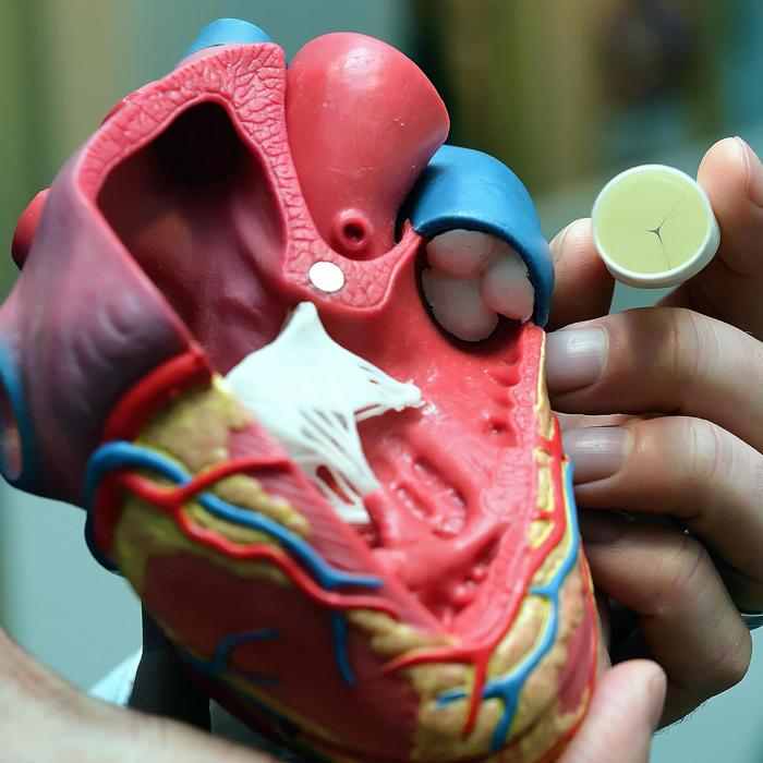 Xeltis: "lebende" Herzklappen aus biologisch abbaubaren Polymeren | Brabant Brand Box